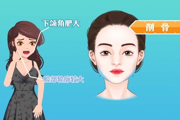 ?深圳醫美整形醫院排行榜 深圳醫美整形醫院排名