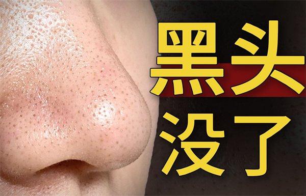 去黑頭產品哪個牌子好？去黑頭還不會大毛孔的護膚品排行榜